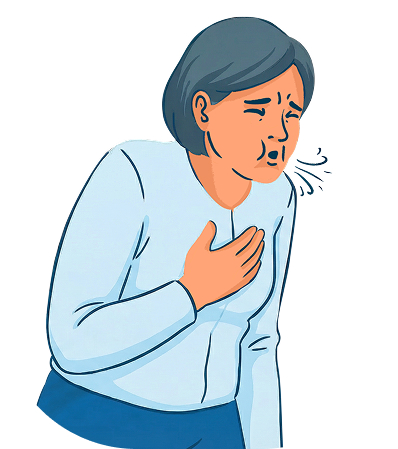 Illustration d'une femme en difficulté respiratoire, main sur la poitrine et exprimant un essoufflement, pour symboliser les symptômes de la BPCO ou de l'insuffisance respiratoire.